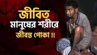 জীবিত মানুষের শরীরে জীবন্ত পোকা!! | বৃদ্ধাশ্রম | Milton Samadder | Child \u0026 Old Age Care.