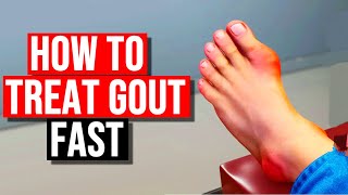 How To Treat Gout in 2024