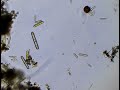 some diatoms in a puddle