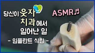 (치과진료ASMR) 임플란트 식립 전과정