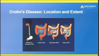 Operative Strategies in Inflammatory Bowel Disease (IBD)