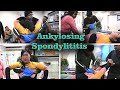 Chiropractic treatment for Ankylosing spondylitis.