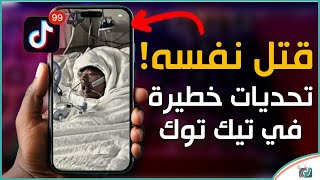 أخطر خمس تحديات عرفتها السوشال ميديا .. شاب يحرق وجهه 😲