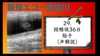 エコー道場29（声解説）授精後36日の胎子