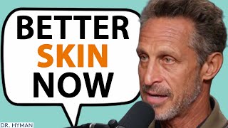 THE ROOT CAUSES Of Acne & How To Prevent It | Mark Hyman