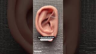 Ear Shen Men Acupuncture Point #acupuncturepoints