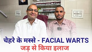 Facial Warts Success Story | चेहरे के मस्सों का होम्योपैथीक में जड़ से इलाज किया