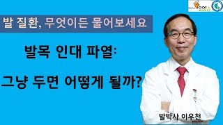 발목인대 파열: 그냥두면 어떻게 되나? [발질환, 무엇이든 물어보세요]