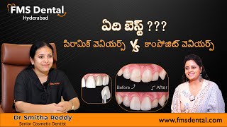 పళ్ళ మధ్యలో సంధులు| Space between teeth | Composite filling | Dr Smitha Reddy | FMS Dental | SumanTV