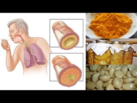 Natural Remedies for Chest Congestion Relief Natural Remedies for Chest Congestion Relief