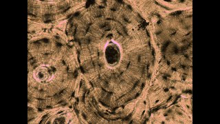Lab 1.5 - Structures of Compact Bone (Microscope)