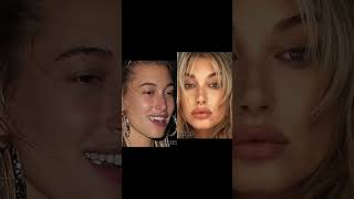Celebrities extreme plastic surgeries #viral #billieeilish #short