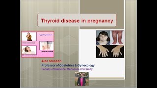 Thyroid disease in pregnancy