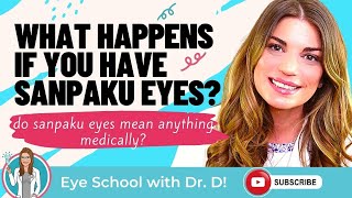 Do Sanpaku Eyes Mean Anything Medically? What Happens If You Have Sanpaku Eyes?