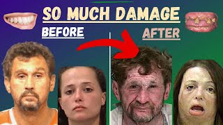 FACES OF METH | Before and After