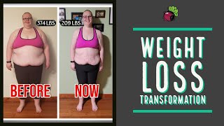 1 Year Weight Loss Transformation // WLS in Mexico - Year in Review | My Gastric Bypass Journey