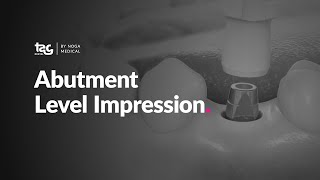 Abutment Level Impression