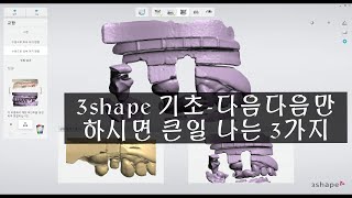 3shape 팁3가지-3shape기초 알아야할 사항 -[부릉]-여러분의 시간을 아껴 드리기 위한팁