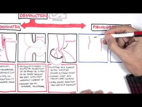 What is the most common cause of intestinal obstruction?