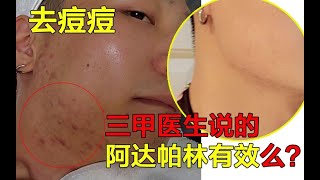 【无名测评】三甲医院开的祛痘药膏有用么？快速且安全的祛痘方法！连续亲测1个月痘痘烂脸修复记录！