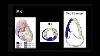 Ischemic Findings on Cardiac Ultrasound (Echocardiography)