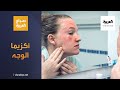 صباح العربية | أكزيما الوجه ما أسبابها وطرق العلاج؟