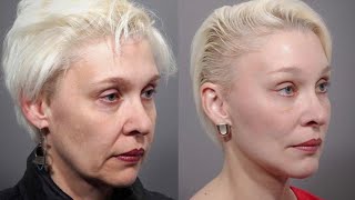 Best Full Face Exercises | 5 minute routine for Wrinkles and Face lift | Blush with me face yoga
