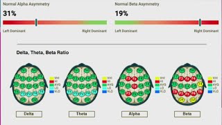 Tennessee Neurofeedback and brain mapping