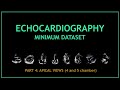 Echocardiogram: Minimum dataset (PART 4: Apical 4 and 5 chamber views)