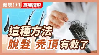 這種方法 脫髮 禿頂有救了| 健康1+1 · 直播精選