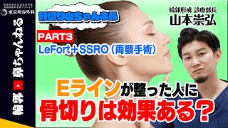 【骨切り山ちゃんネル】Lefort＋SSRO（両顎手術）はEラインがキレイな人には効果あるの？　PART3