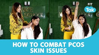 PCOS: How to combat PCOS Skin issues | Skin Issues