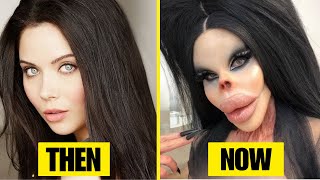 35 Celebrity Plastic Surgery Disasters That Ruined Their Looks | Then and Now 2025