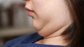 Get Rid of Double Chin FAST ~ Exercises to Lose Neck Fat & Double Chin