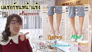 ประสบการณ์ทำเลเซอร์ขนหน้าแข้งครั้งแรก พาบุกห้องทรีทเมนต์ | Mint Weeraya |