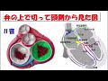 【心房粗動　前編】完全解説　ギザギザしてる理由、時計回りか波形を見ただけで分かるようになる！！