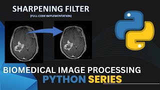 Sharpening filter | Code implementation | Biomedical Image Processing