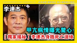 【李連傑離世風波】傳聞背後真相驚人，疑似立遺囑？ 甲亢驚魂過程曝光，醫生警告驚現真相揭秘！ #娛樂 #明星 #李連傑