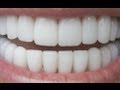 How To Have Natural White Teeth in 3 minutes ( Works 100% ) How To Have Natural White Teeth in 3 minutes ( Works 100% )