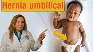 Hernia umbilical en bebés: ¿Qué deben saber los padres? | AAP