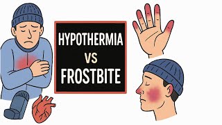 Hypothermia & Frostbite for EMTs | Cold Emergencies Guide