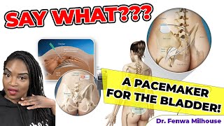 A PACEMAKER FOR OVERACTIVE BLADDER | Dr. Milhouse