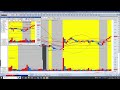 주식투자 hlb 현대adm 경구용항암제글로벌 사업협약에 상한가 hlb 리보세라닙의 힘