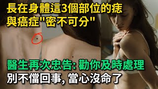 長在身體這3個部位的痣，與癌症“密不可分”，醫生忠告：勸你及時處理。別不儅回事, 當心沒命。【幸福Talks】#中老年心語 #中老年健康 #養老 #養生 #幸福人生 #為人處世 #讀書#佛 #深夜讀書