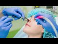 নাকের সৌন্দর্য বর্ধন enhancing the beauty of the nose 4k