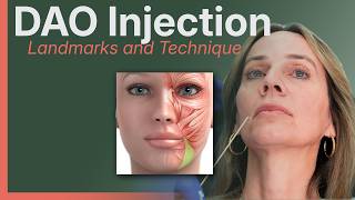 How to Inject the DAO (Without Hitting the DLI) | Neurotoxin Training