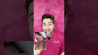 INFLAMED ACNE on the nose
