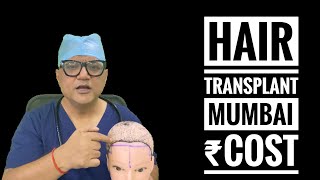 Hair Transplant in Mumbai