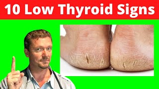 10 Skin Signs of LOW THYROID (Skin Signs of Hypothyroidism) 2024