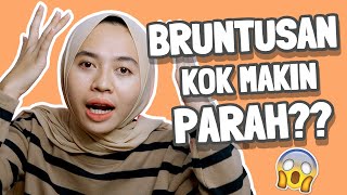 Penyebab Bruntusan Di Wajah Makin Parah Dan Gak Mau Hilang